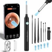 Hopefox Ohrenschmalz-Entferner mit Kamera f&uuml;r nur 6,36&euro;